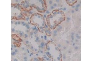 IHC-P analysis of Human Tissue, with DAB staining. (Trichohyalin anticorps  (AA 1851-1943))