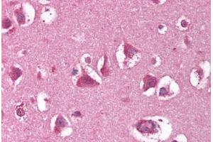 Human Brain, Cortex (formalin-fixed, paraffin-embedded) stained with XRCC5 antibody ABIN214266 at 5 ug/ml followed by biotinylated anti-mouse IgG secondary antibody ABIN481714, alkaline phosphatase-streptavidin and chromogen.
