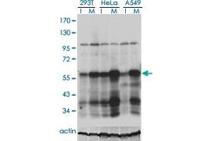 Western blot analysis of PLK1 in extracts from 293T, HeLa and A549 cell using anti-PLK1 monoclonal antibody.