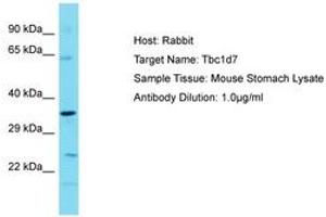 Image no. 1 for anti-TBC1 Domain Family, Member 7 (TBC1D7) (AA 154-203) antibody (ABIN6750375) (TBC1D7 anticorps  (AA 154-203))