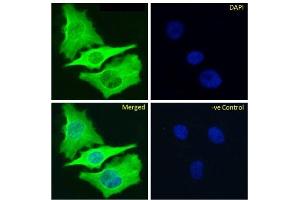 Immunofluoresence staining of fixed HeLa cells with anti-Beta-tubulin antibody S11B.