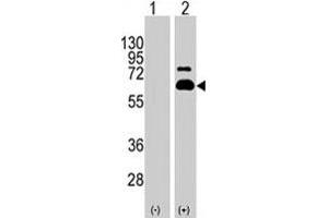 Western blot analysis of RPS6KB1 (arrow) using RPS6KB1 polyclonal antibody . (RPS6KB1 anticorps  (Ser404))