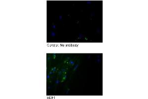 Sample Type :  Fibroblasts