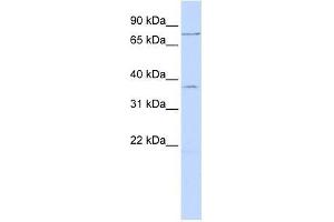 ZNF264 antibody used at 0. (ZNF264 anticorps  (N-Term))