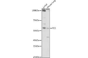 Western blot analysis of extracts of various cell lines, using (ABIN6129576, ABIN6140673, ABIN6140674 and ABIN6221283) at 1:1000 dilution. (FLI1 anticorps  (AA 1-100))