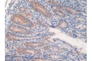 IHC-P analysis of Mouse Intestine Tissue, with DAB staining. (WARS anticorps  (AA 29-195))