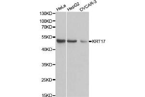 Western blot analysis of extracts of various cell lines, using KRT17 antibody. (KRT17 anticorps  (AA 133-432))