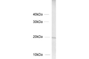 Western Blotting (WB) image for anti-Actin Related Protein 2/3 Complex, Subunit 3, 21kDa (ARPC3) (AA 109-120) antibody (ABIN1742555)