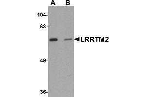 Western Blotting (WB) image for anti-Leucine Rich Repeat Transmembrane Neuronal 2 (LRRTM2) (C-Term) antibody (ABIN1030497) (LRRTM2 anticorps  (C-Term))
