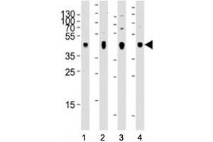 Western blot analysis of lysate from 1) human skeletal muscle, 2) human brain, 3) mouse brain, and 4) rat brain tissue using PDK2 antibody at 1:2000 for each lane.