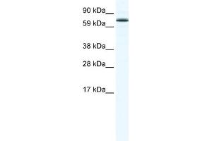 WB Suggested Anti-FOXO6 Antibody Titration:  1.