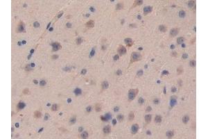 Detection of CDH16 in Mouse Brain Tissue using Polyclonal Antibody to Cadherin 16 (CDH16) (Cadherin-16 anticorps  (AA 353-617))