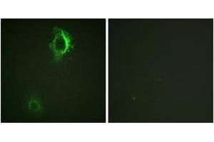 Immunofluorescence analysis of HepG2 cells, using CD5 (Phospho-Tyr453) Antibody.