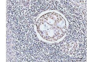 IHC analysis of KIFC1 using anti-KIFC1 antibody (ABIN7599523). (KIFC1 anticorps  (AA 1-673))