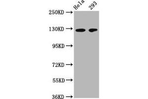 Western Blot Positive WB detected in: Hela whole cell lysate, 293 whole cell lysate All lanes: CD146 antibody at 1:500 Secondary Goat polyclonal to Mouse IgG at 1/50000 dilution Predicted band size: 72, 58 kDa Observed band size: 120 kDa (MCAM anticorps  (AA 50-646))