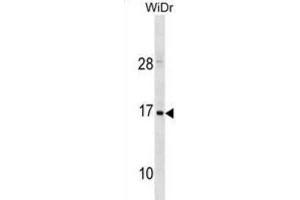 Western Blotting (WB) image for anti-Hemoglobin, zeta (HBZ) antibody (ABIN3001037) (HBZ anticorps)