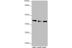 Western blot All lanes: DYNC2LI1 antibody at 1.