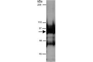 Western blot analysis of CYTSB in HeLa whole cell lysate (RIPA) using CYTSB polyclonal antibody  at 0. (NSP5 anticorps  (AA 200-300))
