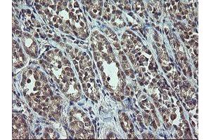 Image no. 1 for anti-Cyclin-Dependent Kinase Inhibitor 2B (p15, Inhibits CDK4) (CDKN2B) antibody (ABIN1497445) (CDKN2B anticorps)