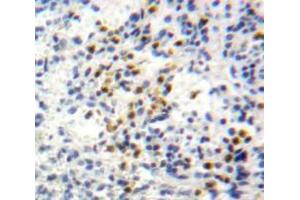 IHC-P analysis of Spleen tissue, with DAB staining. (CXCL1 anticorps  (AA 35-107))