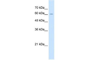 WB Suggested Anti-ZP2 Antibody Titration:  2. (ZP2 anticorps  (C-Term))