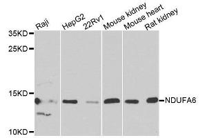 Western blot analysis of extracts of various cell lines, using NDUFA6 antibody. (NDUFA6 anticorps  (AA 35-154))