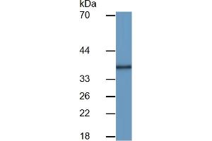 Detection antibody from the kit in WB with Positive Control:  Sample Human brain lysate.