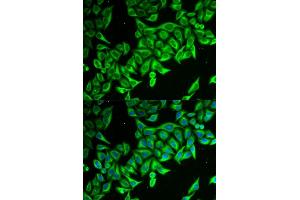 Immunofluorescence analysis of MCF-7 cells using DAP antibody (ABIN6130322, ABIN6139397, ABIN6139398 and ABIN6221757). (DAP anticorps  (AA 1-102))
