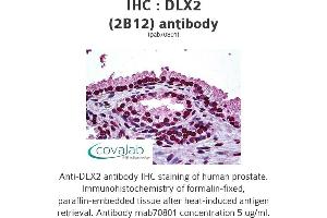 Image no. 1 for anti-Distal-Less Homeobox Protein 2 (DLX2) (AA 1-110) antibody (ABIN1723650) (DLX2 anticorps  (AA 1-110))