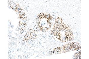 Immunohistochemistry (IHC) image for anti-alpha 1 Sodium Potassium Atpase antibody (ABIN7455086) (alpha 1 Sodium Potassium Atpase anticorps)