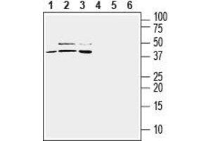 Western blot analysis of mouse BV-2 microglia (lanes 1 and 4), human U-87 MG glioblastoma (lanes 2 and 5) and human THP-1 monocytic leukemia (lanes 3 and 6) cell line lysates: - 1-3. (TREM2 anticorps  (Extracellular, N-Term))