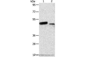 Western blot analysis of Human liver cancer and normal liver tissue, using RARB Polyclonal Antibody at dilution of 1:500