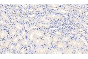 Detection of IL1b in Caprine Kidney Tissue using Polyclonal Antibody to Interleukin 1 Beta (IL1b)