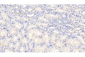 Detection of IL1b in Caprine Kidney Tissue using Polyclonal Antibody to Interleukin 1 Beta (IL1b) (IL-1 beta anticorps  (AA 1-266))