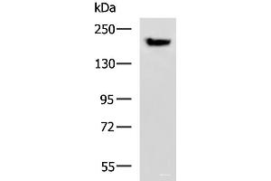 Western blot analysis of Mouse brain tissue lysate using PDS5B Polyclonal Antibody at dilution of 1:800 (PDS5B anticorps)