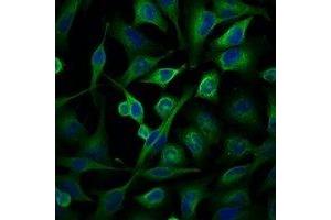 Immunofluorescent analysis of Alpha-tubulin staining in Hela cells. (alpha Tubulin anticorps)