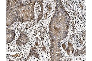 IHC analysis of PARK7/DJ1 using anti-PARK7/DJ1 antibody (ABIN7600468). (PARK7/DJ1 anticorps  (AA 2-189))