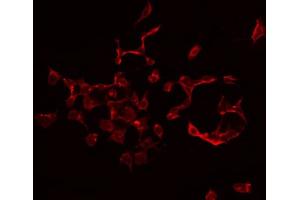 ABIN6272328 staining 293 by IF/ICC.