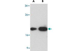Western blot analysis of (A) 25 and (B) 125 ng of LY96 recombinant protein with LY96 monoclonal antibody, clone 1A2E3  at 1 ug/mL . (LY96 anticorps  (AA 2-160))