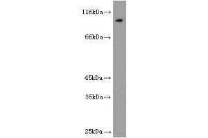 Image no. 1 for anti-Luteinizing Hormone/Choriogonadotropin Receptor (LHCGR) antibody (ABIN2937954) (LHCGR anticorps)