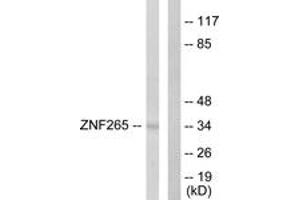 Western blot analysis of extracts from HeLa cells, using ZNF265 Antibody. (ZNF265 anticorps  (AA 106-155))