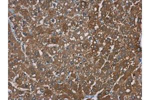 IHC-P Image TRPM2 antibody [N1N2-2], N-term detects TRPM2 protein at cytoplasm in rat liver by immunohistochemical analysis.