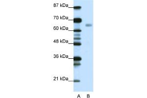 WB Suggested Anti-HSF1 Antibody Titration:  0. (HSF1 anticorps  (C-Term))