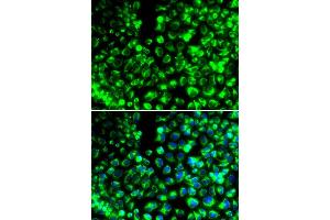 Immunofluorescence analysis of HeLa cell using CALU antibody. (CALU anticorps)