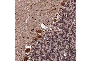 Immunohistochemical staining of human cerebellum with OSBPL1A polyclonal antibody  shows strong cytoplasmic and nuclear positivity in Purkinje cells.