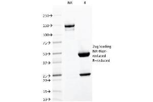 SDS-PAGE Analysis Purified CD103 Mouse Monoclonal Antibody (ITGAE/2063). (CD103 anticorps)