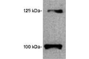Image no. 1 for anti-Leptin Receptor (LEPR) (AA 577-594) antibody (ABIN187816) (Leptin Receptor anticorps  (AA 577-594))