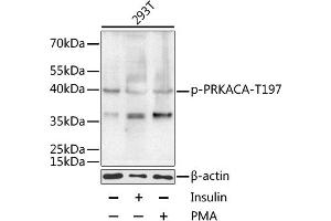 Western blot analysis of extracts of 293T cells, using Phospho-PKA C-alpha (PRKACA)-T197 antibody (ABIN6135290, ABIN6136202, ABIN6136203 and ABIN6225582) at 1:1000 dilution. (PRKACA anticorps  (pThr197))