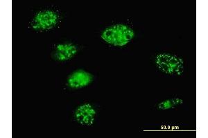 Immunofluorescence of monoclonal antibody to SMARCD3 on HeLa cell. (SMARCD3 anticorps  (AA 385-483))