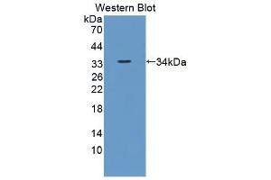 Detection of Recombinant UBR4, Human using Polyclonal Antibody to Ubiquitin Protein Ligase E3 Component N-Recognin 4 (UBR4) (UBR4 anticorps  (AA 124-396))